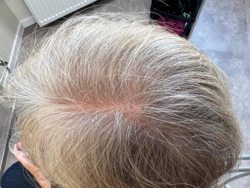 Frisurenbeispiele Vorher/Nachher