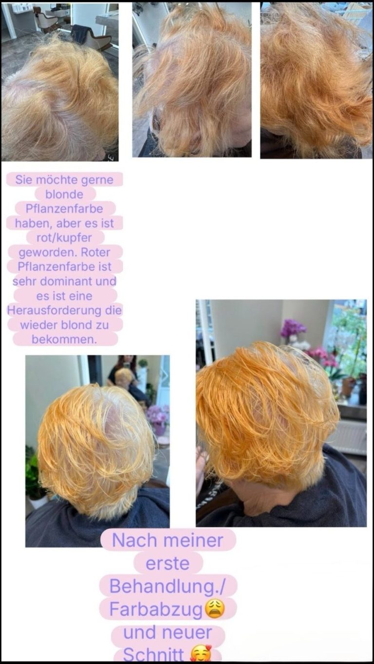 hier sieht man eine missglückte Behandlung...